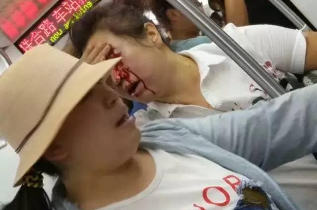 女子激怒孕婦臉被砸,你肚里孩子早晚得掉 女子激怒孕婦臉被砸,你肚里孩子早晚得掉
