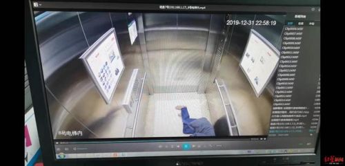 醫(yī)生站著睡著磕斷兩顆門牙詳細(xì)經(jīng)過 醫(yī)生站著睡著磕斷門牙怎么回事