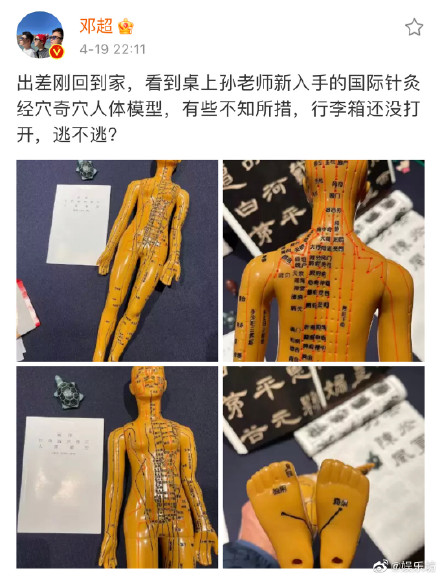 鄧超看見孫儷的針灸模型在線問網(wǎng)友逃不逃 網(wǎng)友:逃是逃不掉了