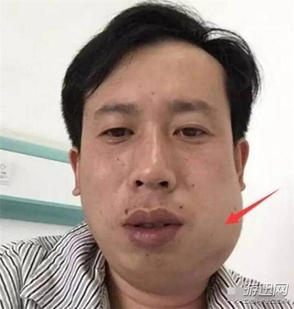 不作死就不會(huì)死!兩名網(wǎng)友用700根皮筋勒西瓜結(jié)局感人 不作死就不會(huì)死!兩名網(wǎng)友用700根皮筋勒西瓜結(jié)局感人